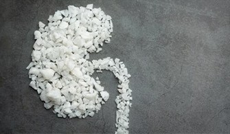 Mikor gondoljunk primer hyperoxaluriára gyermekkorban?